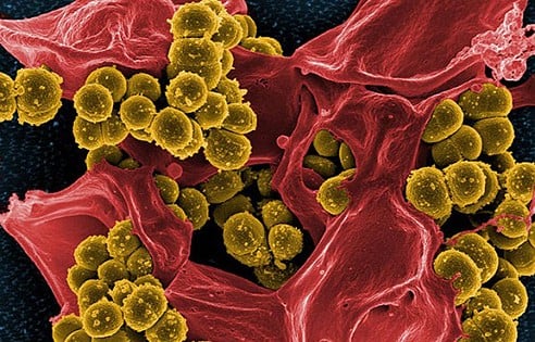 UCSD Biologists Develop Faster Method for Identifying Antibiotics