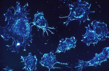 Anti-Cancer Drug Makes Cancer Cells Self-Destruct
