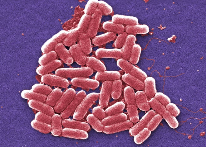 escherichia-coli-sem-cdc-janice-haney-carr