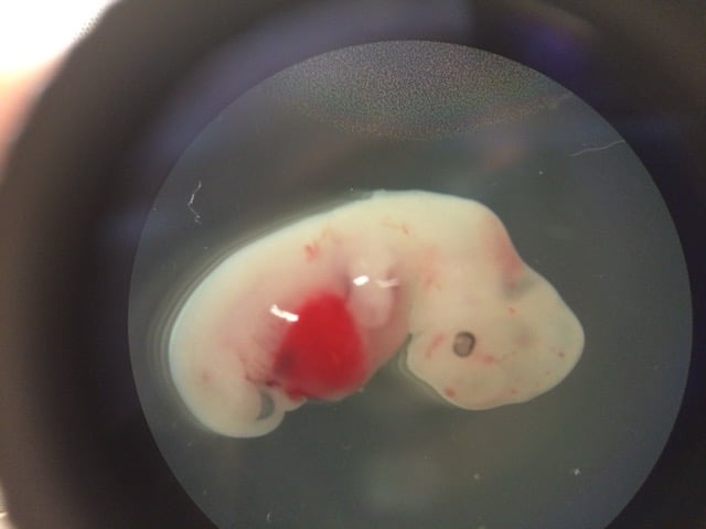 Four-week-old pig embryo injected with human stem cells. (Photo courtesy of Salk Institute)
